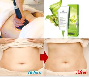 一気にシェイプ Perfect Body