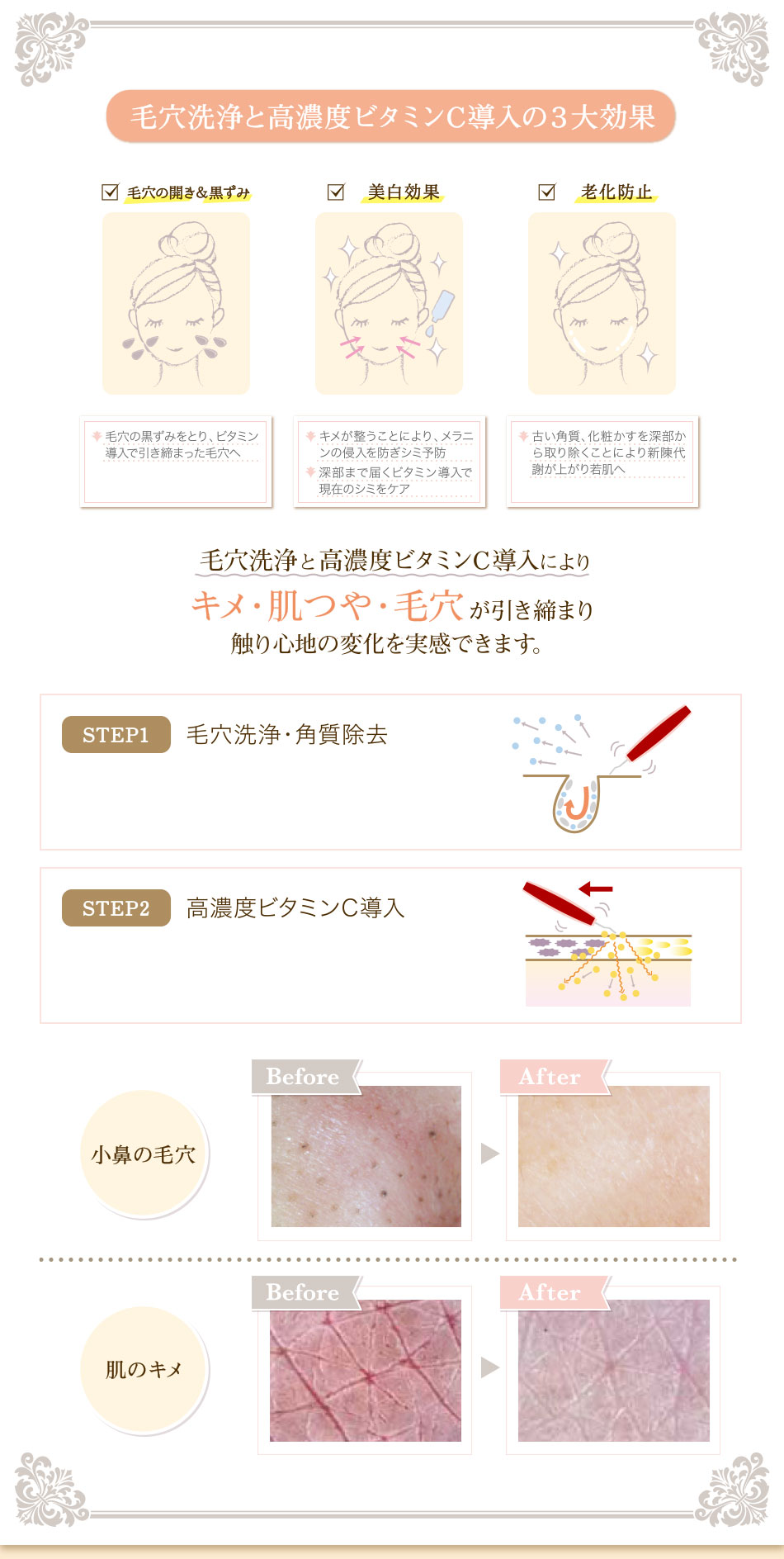 毛穴洗浄と高濃度ビタミンC導入の３大効果